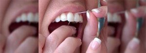 Flossing - Tooth Decay