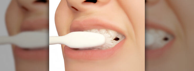 Teeth Whitening